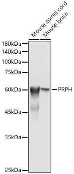 PRPH Rabbit pAb
