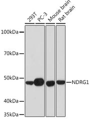 NDRG1 Rabbit mAb