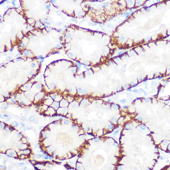 NDRG1 Rabbit mAb