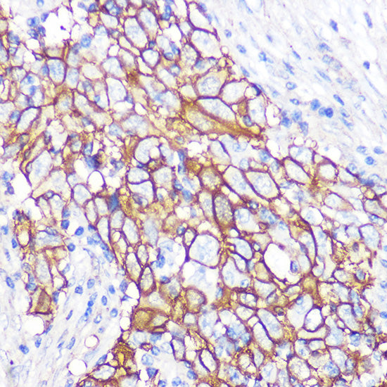 NDRG1 Rabbit mAb