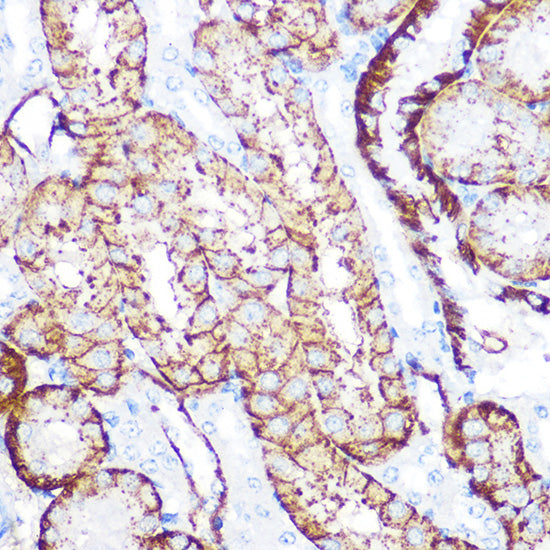NDRG1 Rabbit mAb
