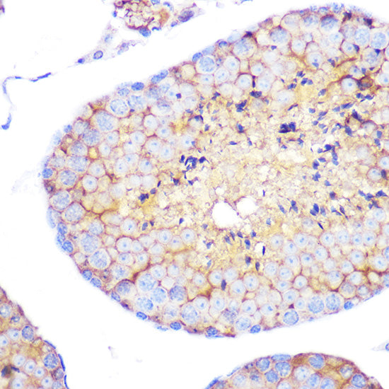 Integrin alpha 4 (ITGA4/CD49d) Rabbit mAb