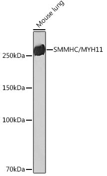 SMMHC/MYH11 Rabbit mAb