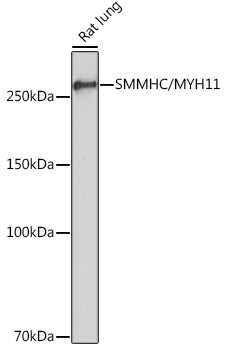 SMMHC/MYH11 Rabbit mAb