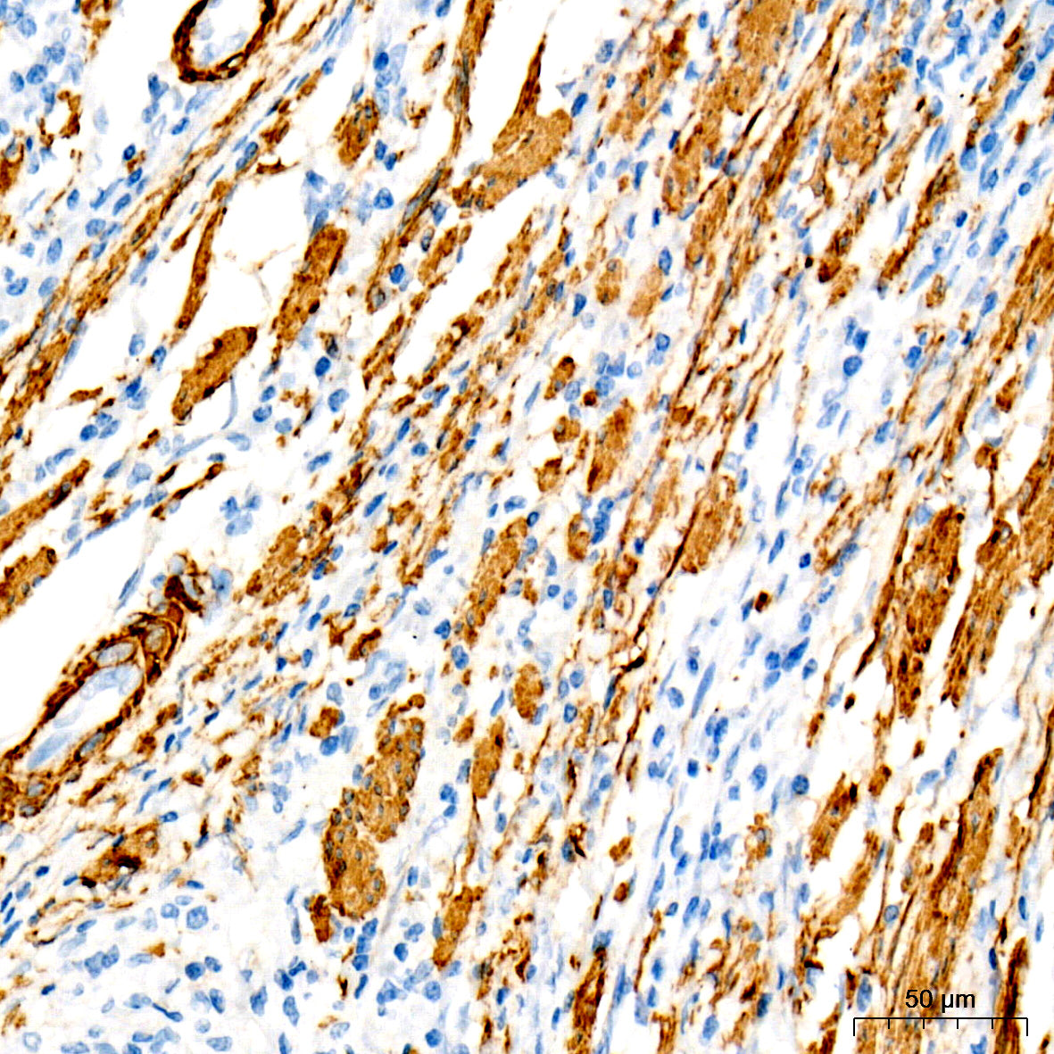 SMMHC/MYH11 Rabbit mAb