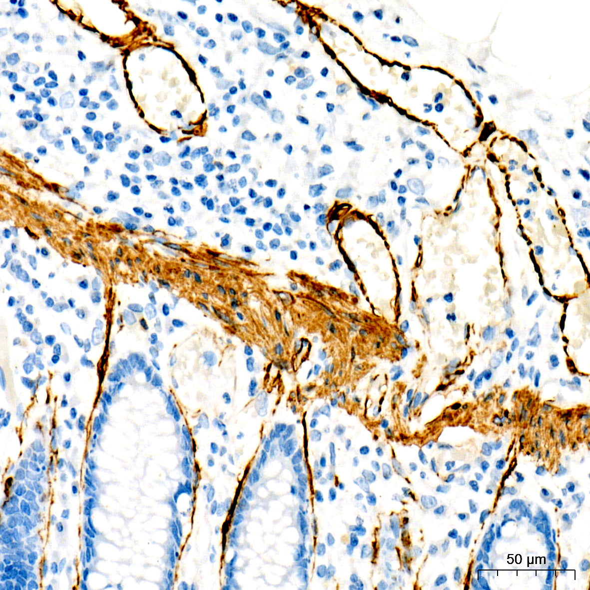 SMMHC/MYH11 Rabbit mAb