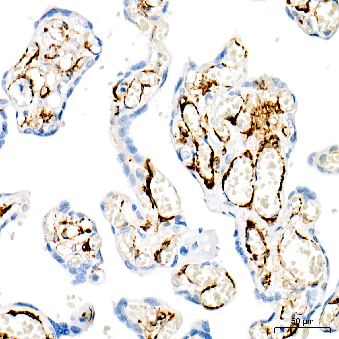 SMMHC/MYH11 Rabbit mAb