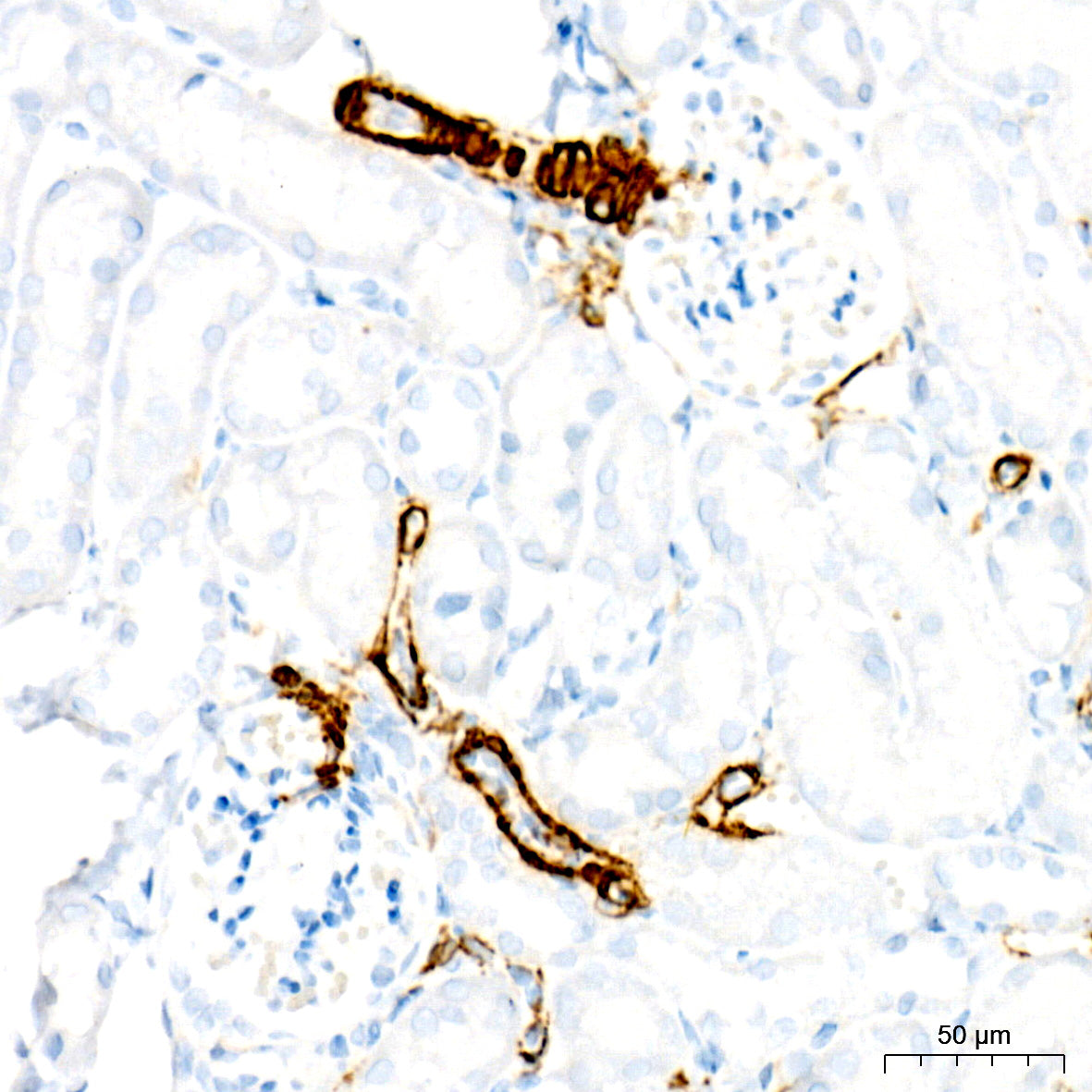 SMMHC/MYH11 Rabbit mAb
