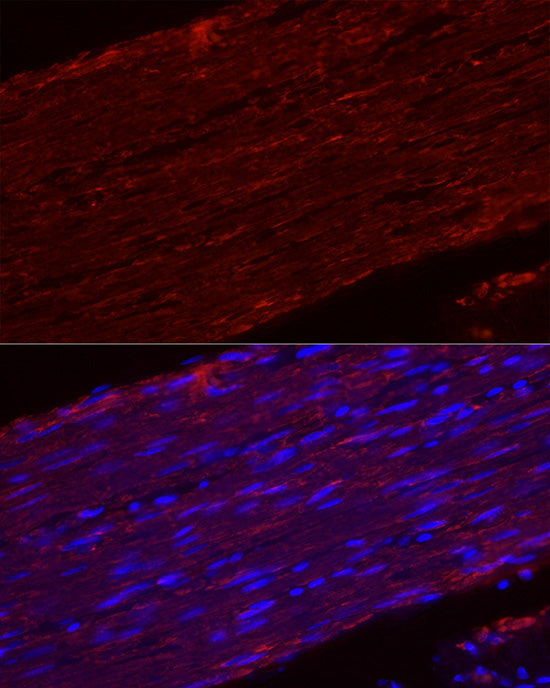 SMMHC/MYH11 Rabbit mAb