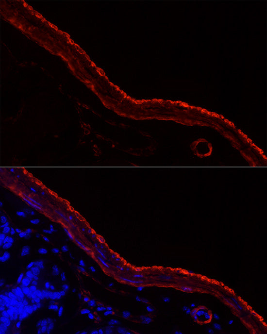 SMMHC/MYH11 Rabbit mAb
