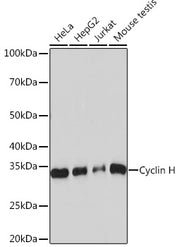 Cyclin H Rabbit mAb