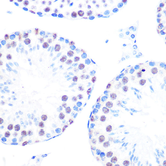 Cyclin H Rabbit mAb