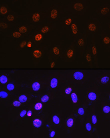 Cyclin H Rabbit mAb