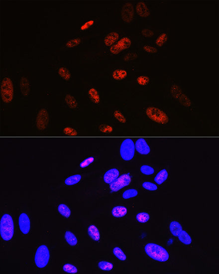 Cyclin H Rabbit mAb