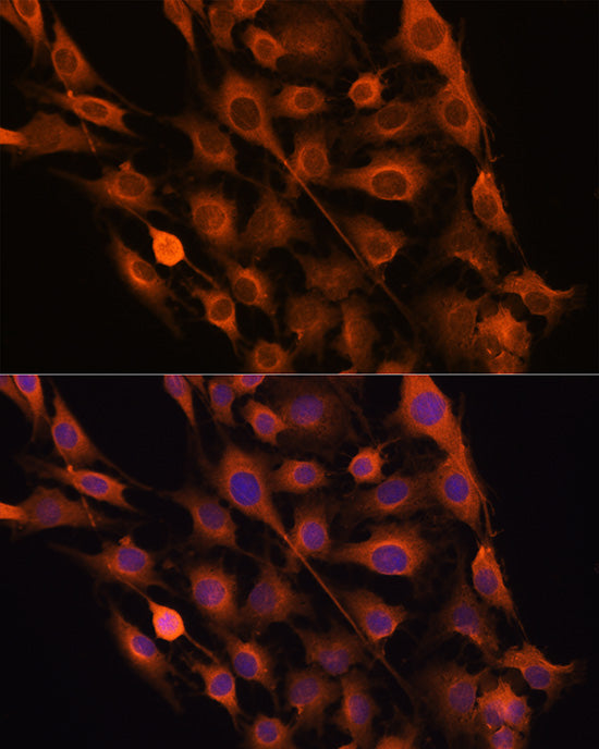 RNH1 Rabbit pAb
