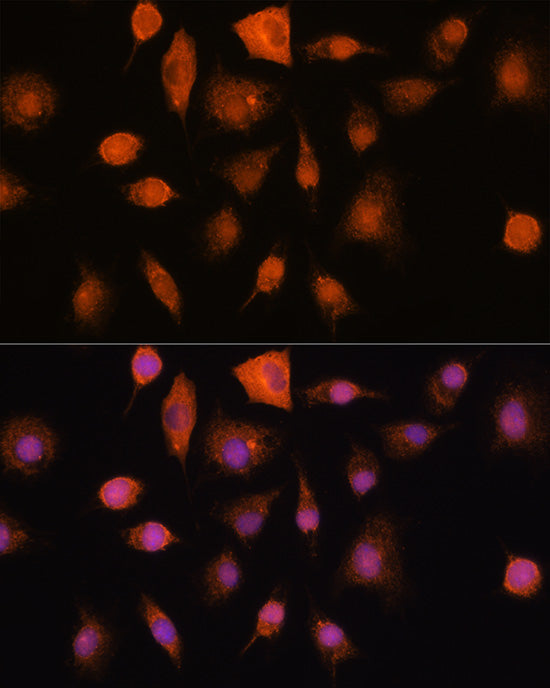 RNH1 Rabbit pAb
