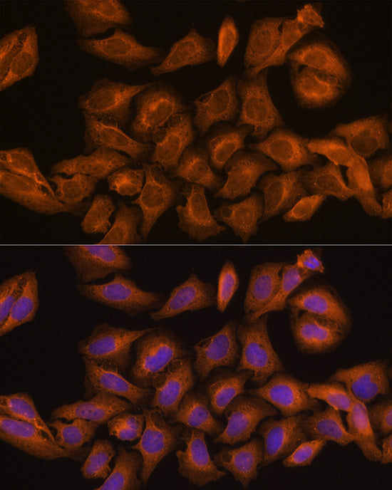 RNH1 Rabbit pAb