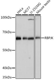 RBPJK Rabbit mAb