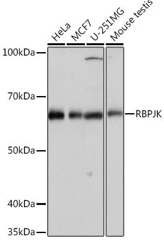 RBPJK Rabbit mAb