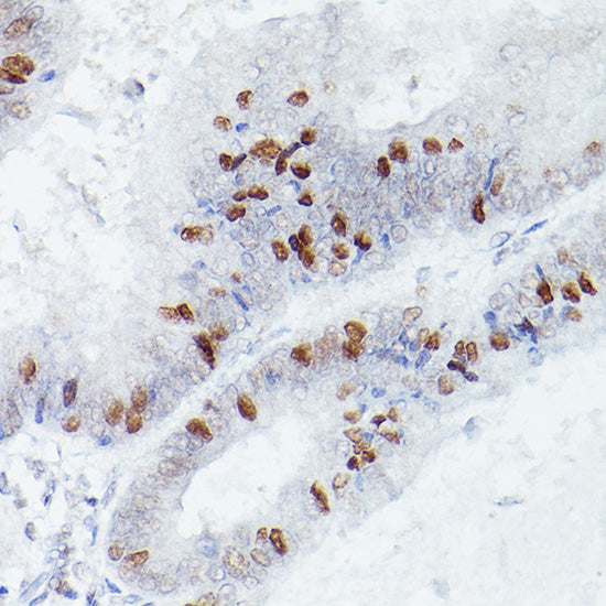 RBPJK Rabbit mAb
