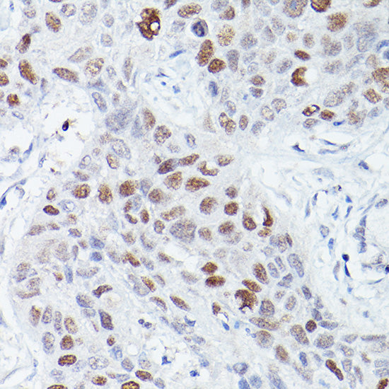 RBPJK Rabbit mAb