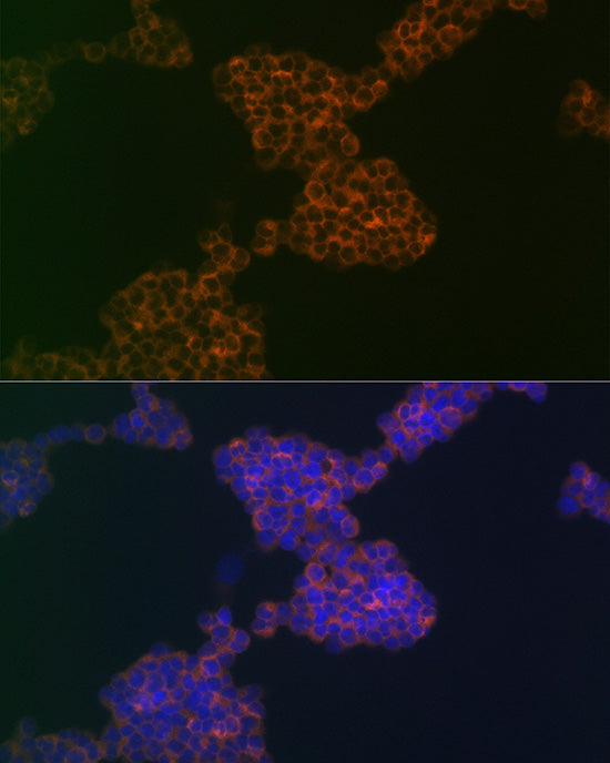 CD3G Rabbit mAb
