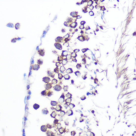 JAB1/CSN5/COPS5 Rabbit mAb