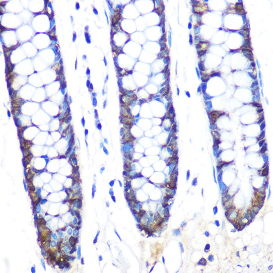 JAB1/CSN5/COPS5 Rabbit mAb