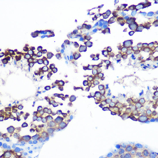 JAB1/CSN5/COPS5 Rabbit mAb