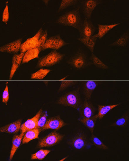 JAB1/CSN5/COPS5 Rabbit mAb