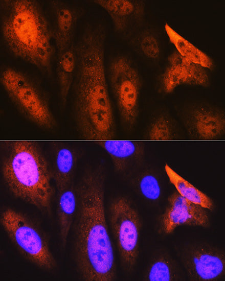JAB1/CSN5/COPS5 Rabbit mAb