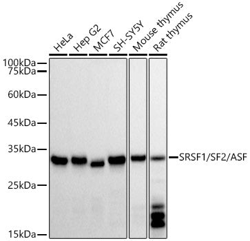 SRSF1/SF2/ASF Rabbit mAb