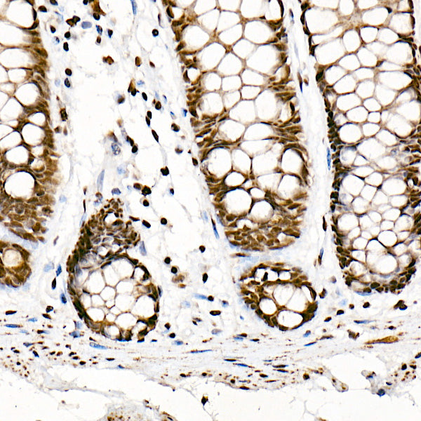 SRSF1/SF2/ASF Rabbit mAb