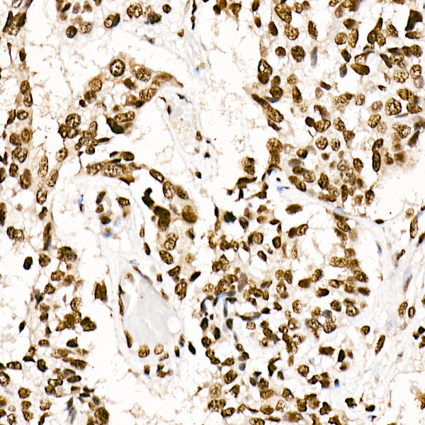 SRSF1/SF2/ASF Rabbit mAb