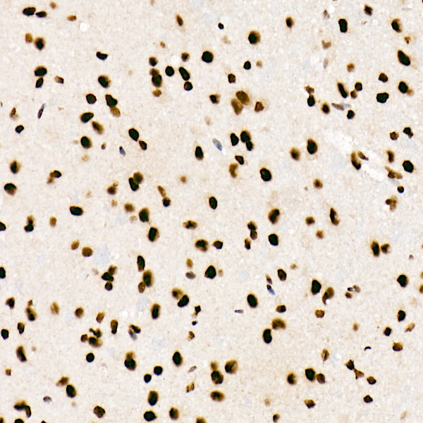 SRSF1/SF2/ASF Rabbit mAb