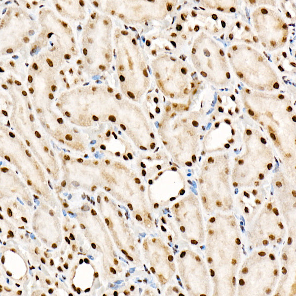 SRSF1/SF2/ASF Rabbit mAb