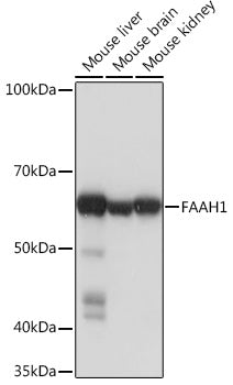 FAAH1 Rabbit mAb