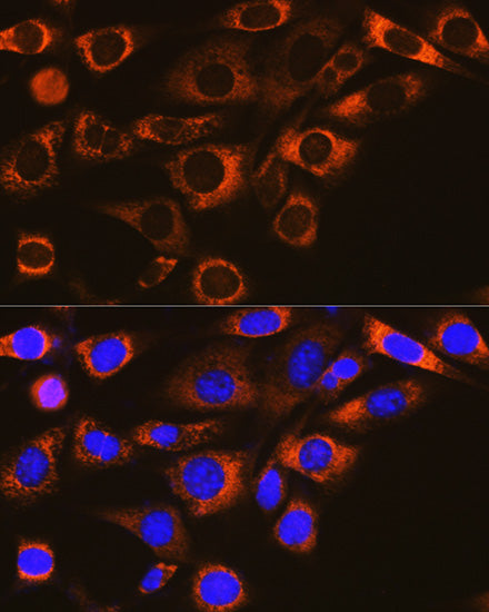 FAAH1 Rabbit mAb