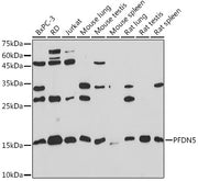 PFDN5 Rabbit mAb