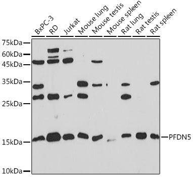 PFDN5 Rabbit mAb