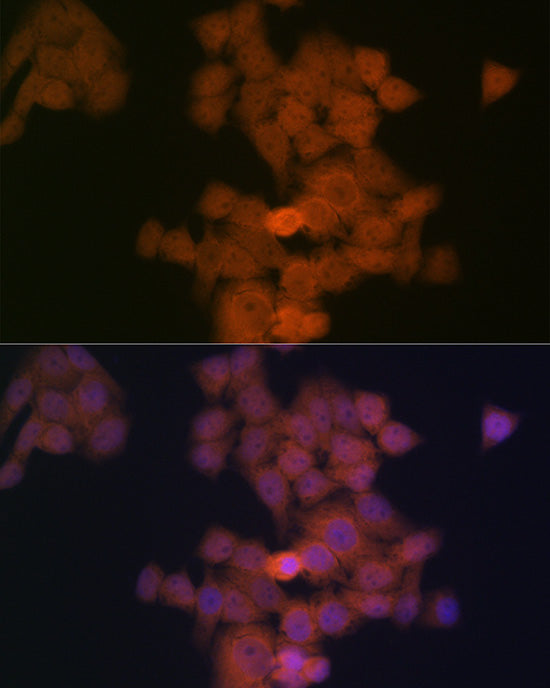PFDN5 Rabbit mAb