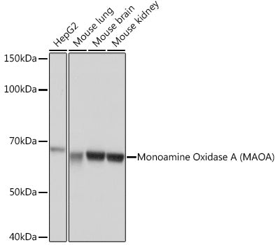Monoamine Oxidase A (MAOA) Rabbit mAb