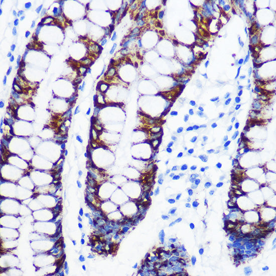 Monoamine Oxidase A (MAOA) Rabbit mAb