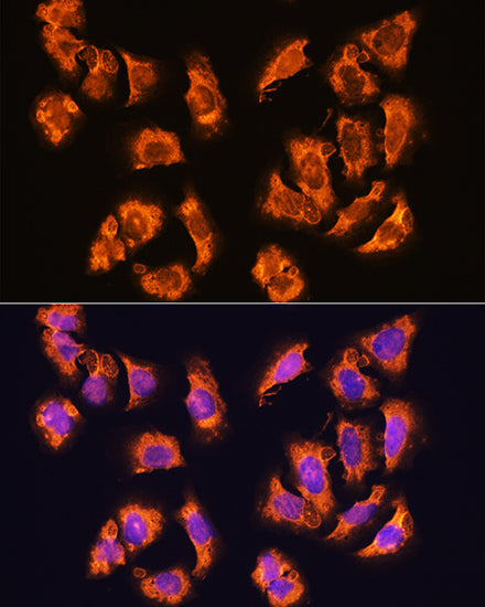 alpha Sarcoglycan (SGCA) Rabbit pAb