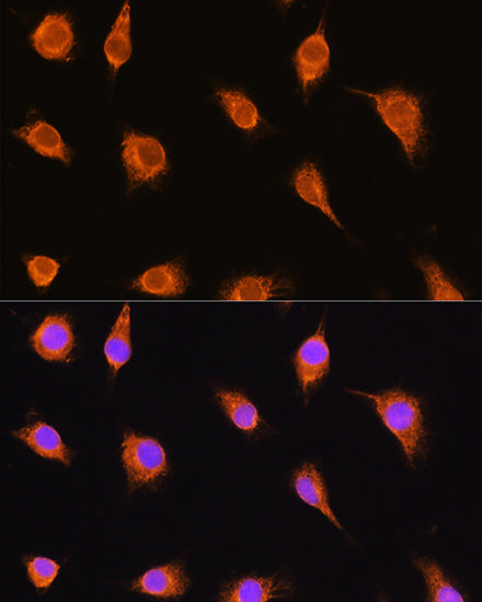 alpha Sarcoglycan (SGCA) Rabbit pAb