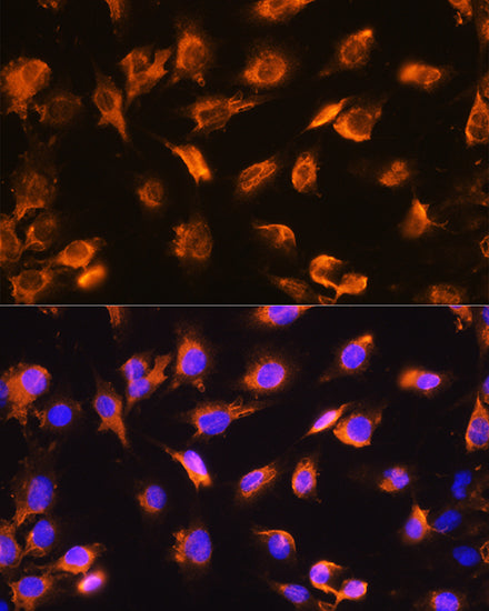 alpha Sarcoglycan (SGCA) Rabbit pAb