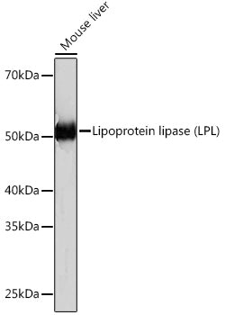 Lipoprotein lipase (LPL) Rabbit mAb