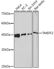 TMEFF2 Rabbit mAb