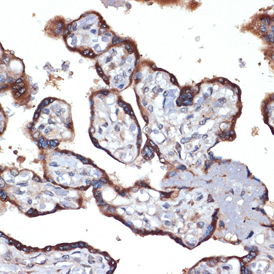 TMEFF2 Rabbit mAb