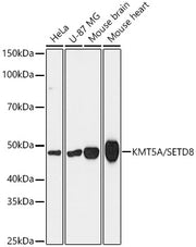 [KD Validated] KMT5A/SETD8 Rabbit mAb